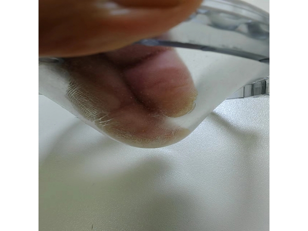 医用凝胶制品